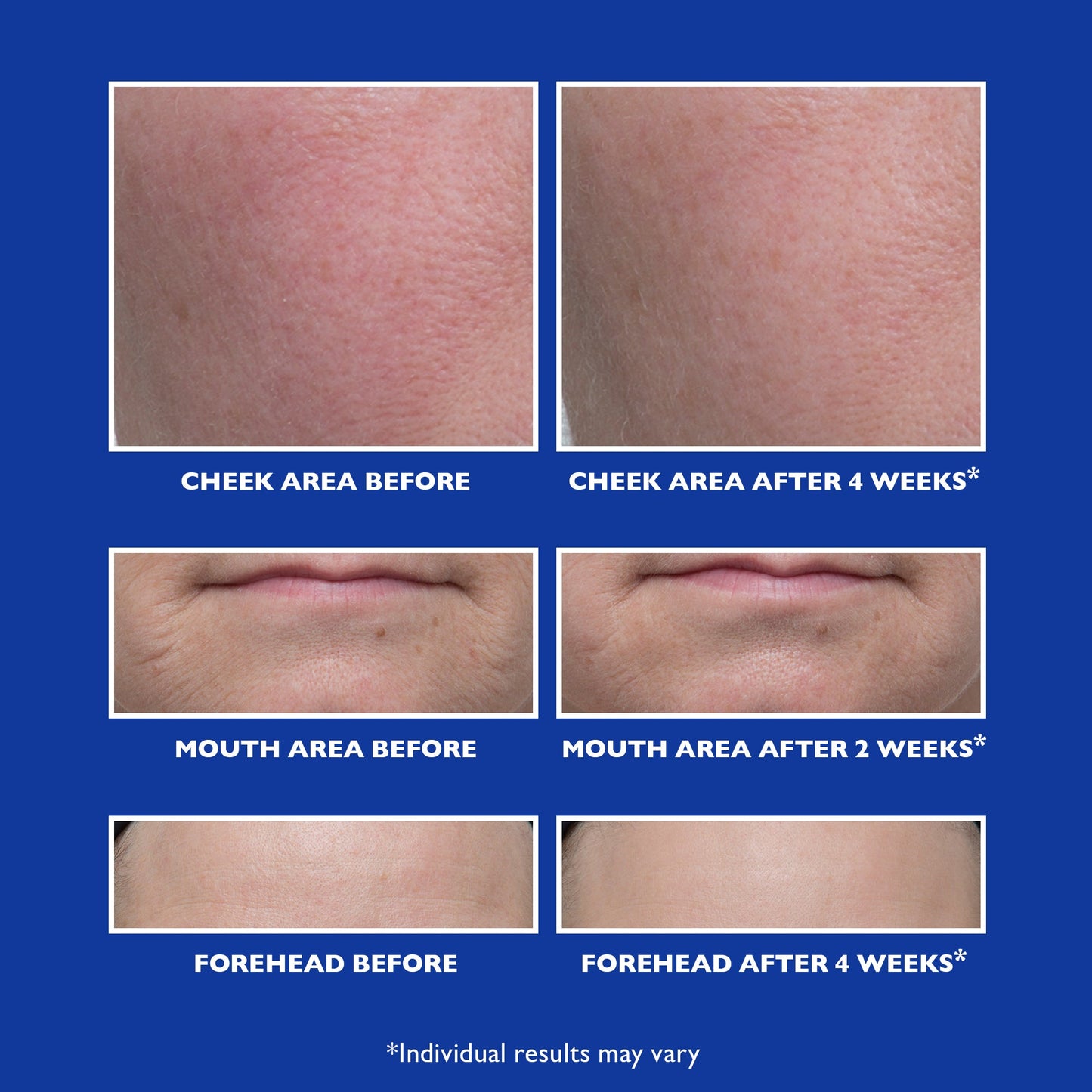 Retinol Fusion PM Night Serum|1.0 fl oz